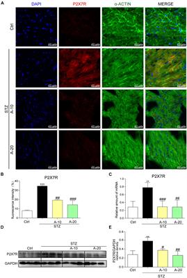 P2X7 Receptor Deficiency Ameliorates STZ-induced Cardiac Damage and Remodeling Through PKCβ and ERK